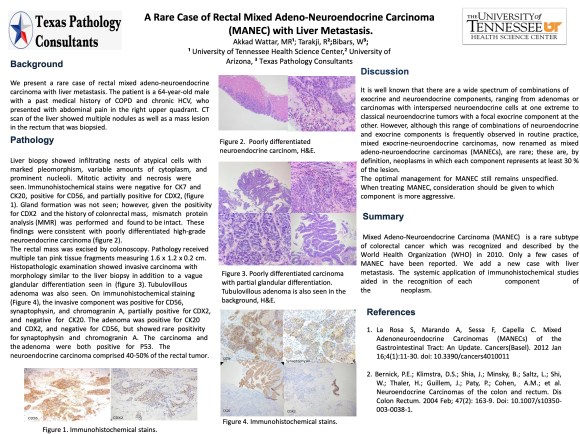 The ASCP 2021 poster presented by Dr. Bibars and colleagues